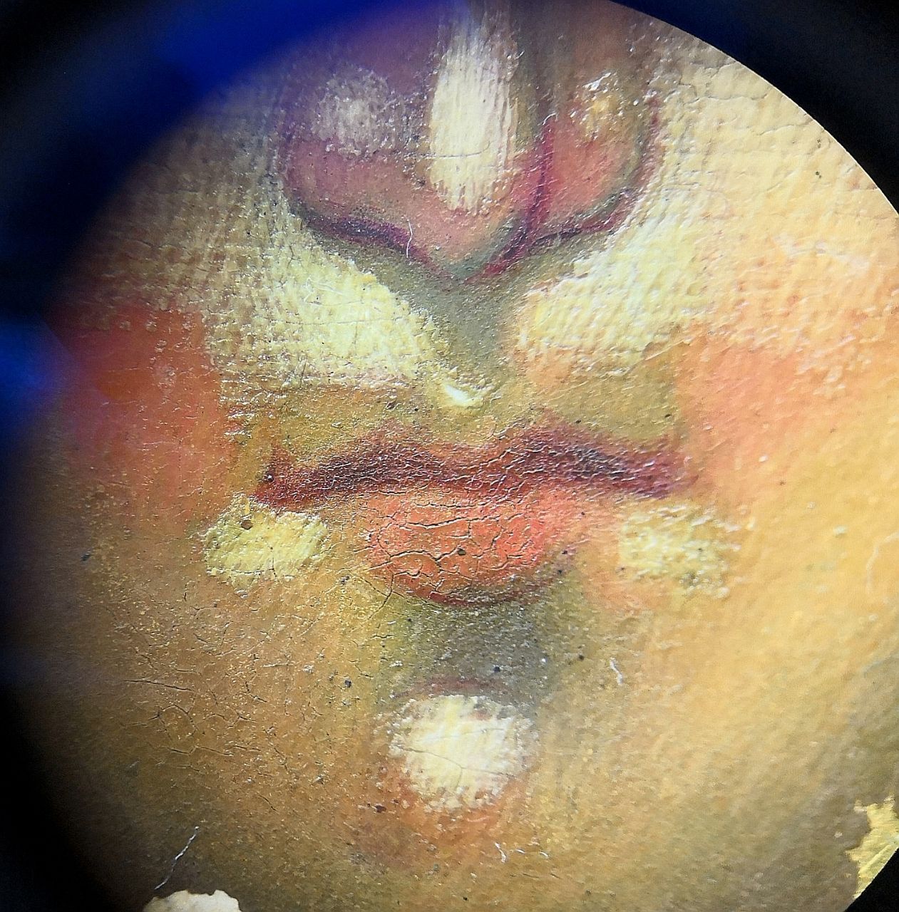 Restoration example 7